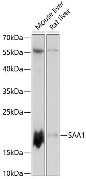 SAA1 Rabbit Polyclonal Antibody