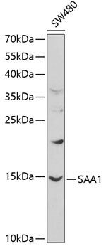 SAA1 Rabbit Polyclonal Antibody