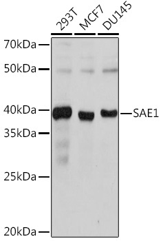 SAE1 Rabbit Monoclonal Antibody