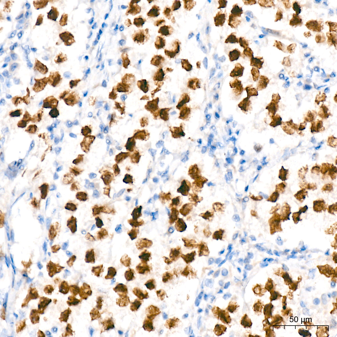 Sall4 Rabbit Monoclonal Antibody - Image 2