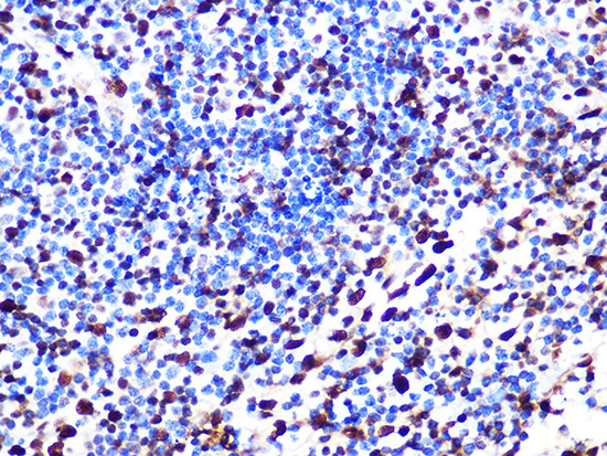 SAMHD1 Rabbit Monoclonal Antibody - Image 2