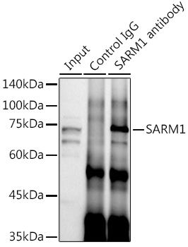 SARM1 Rabbit Polyclonal Antibody - Image 2