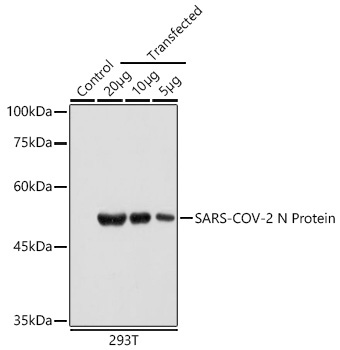 SARS-CoV-2 N Protein Mouse Monoclonal Antibody