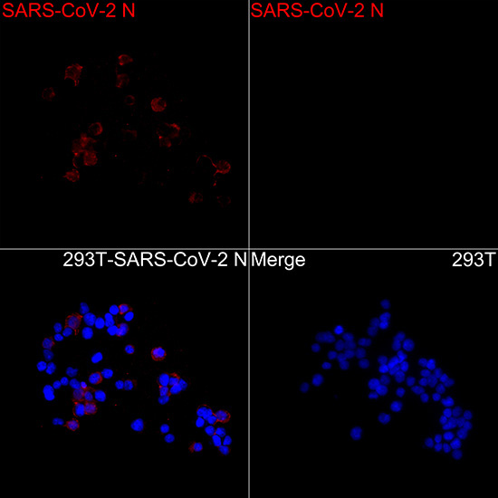 SARS-CoV-2 N Protein Mouse Monoclonal Antibody - Image 2