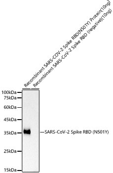 SARS-CoV-2 Spike RBD (N501Y) Rabbit Monoclonal Antibody