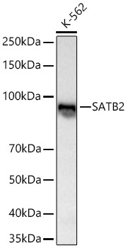 SATB2 Rabbit Monoclonal Antibody