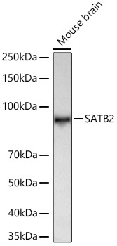 SATB2 Rabbit Monoclonal Antibody - Image 2