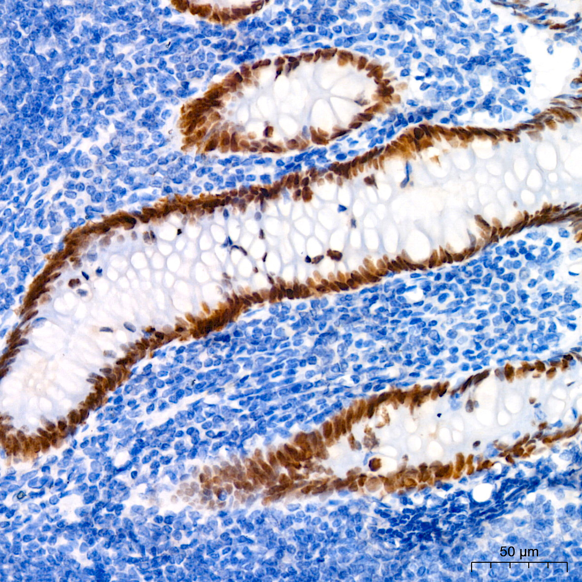 SATB2 Rabbit Monoclonal Antibody - Image 3