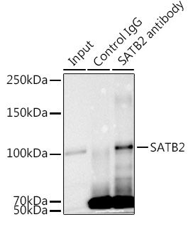 SATB2 Rabbit Monoclonal Antibody - Image 6