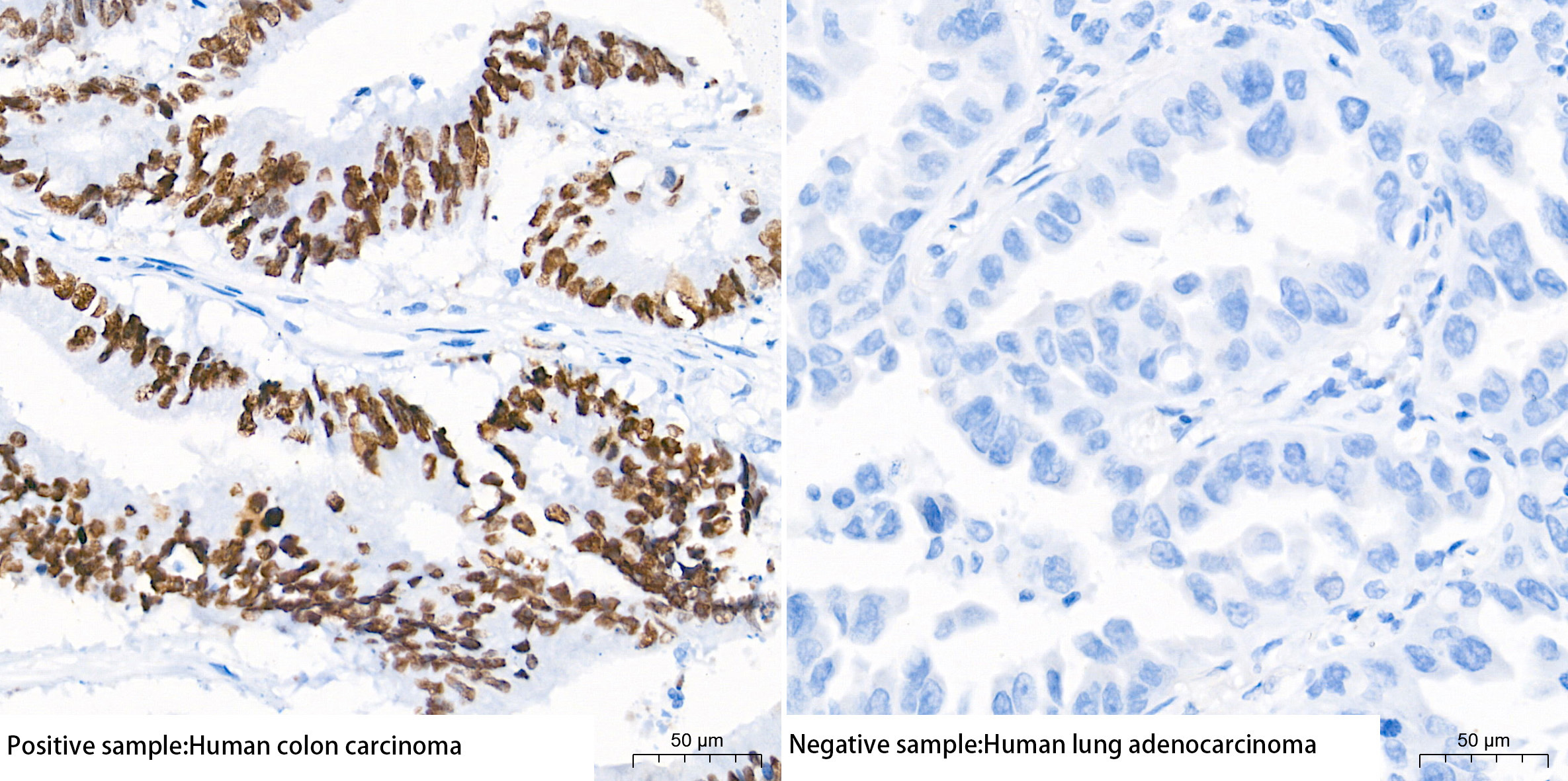 SATB2 Rabbit Monoclonal Antibody - Image 2