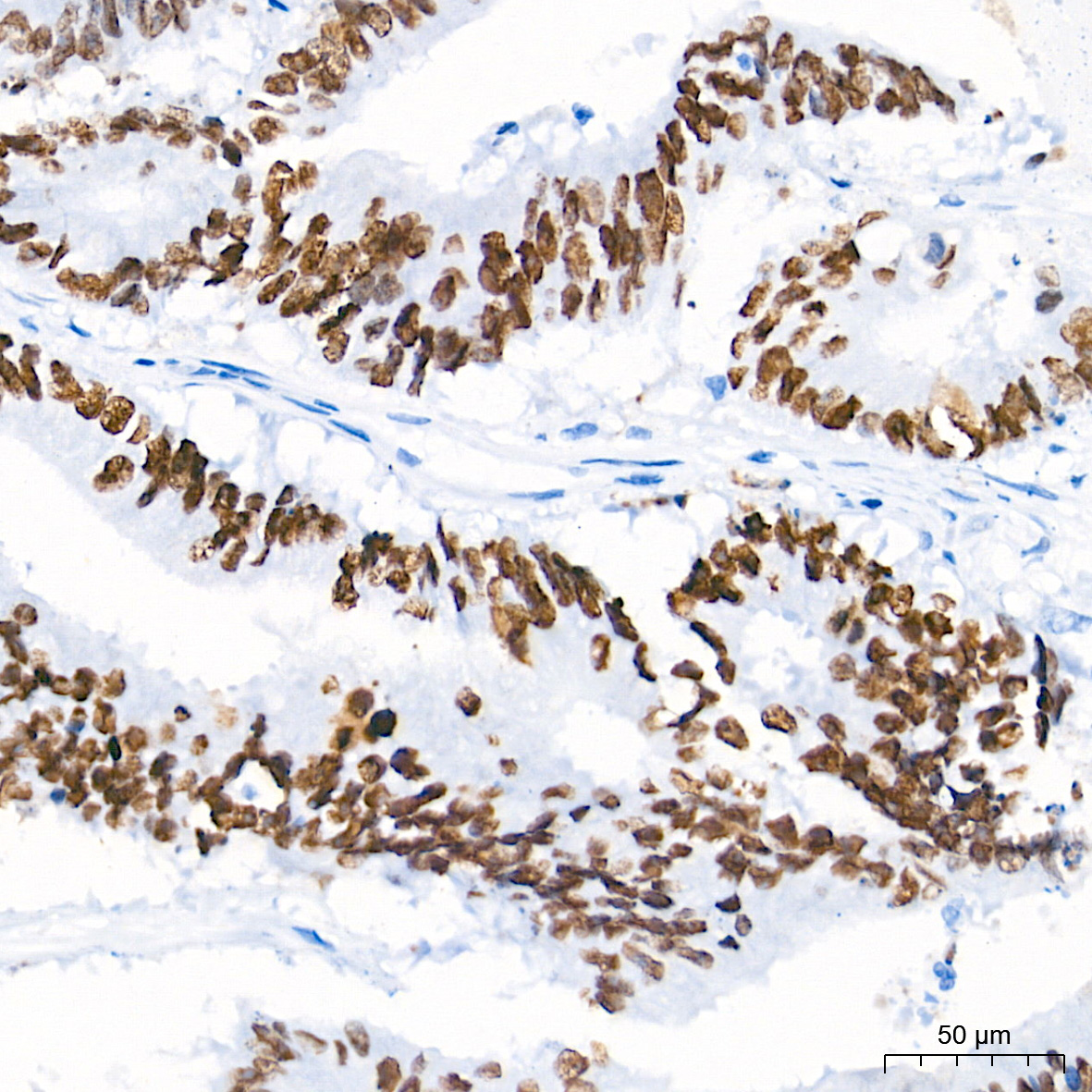 SATB2 Rabbit Monoclonal Antibody - Image 4