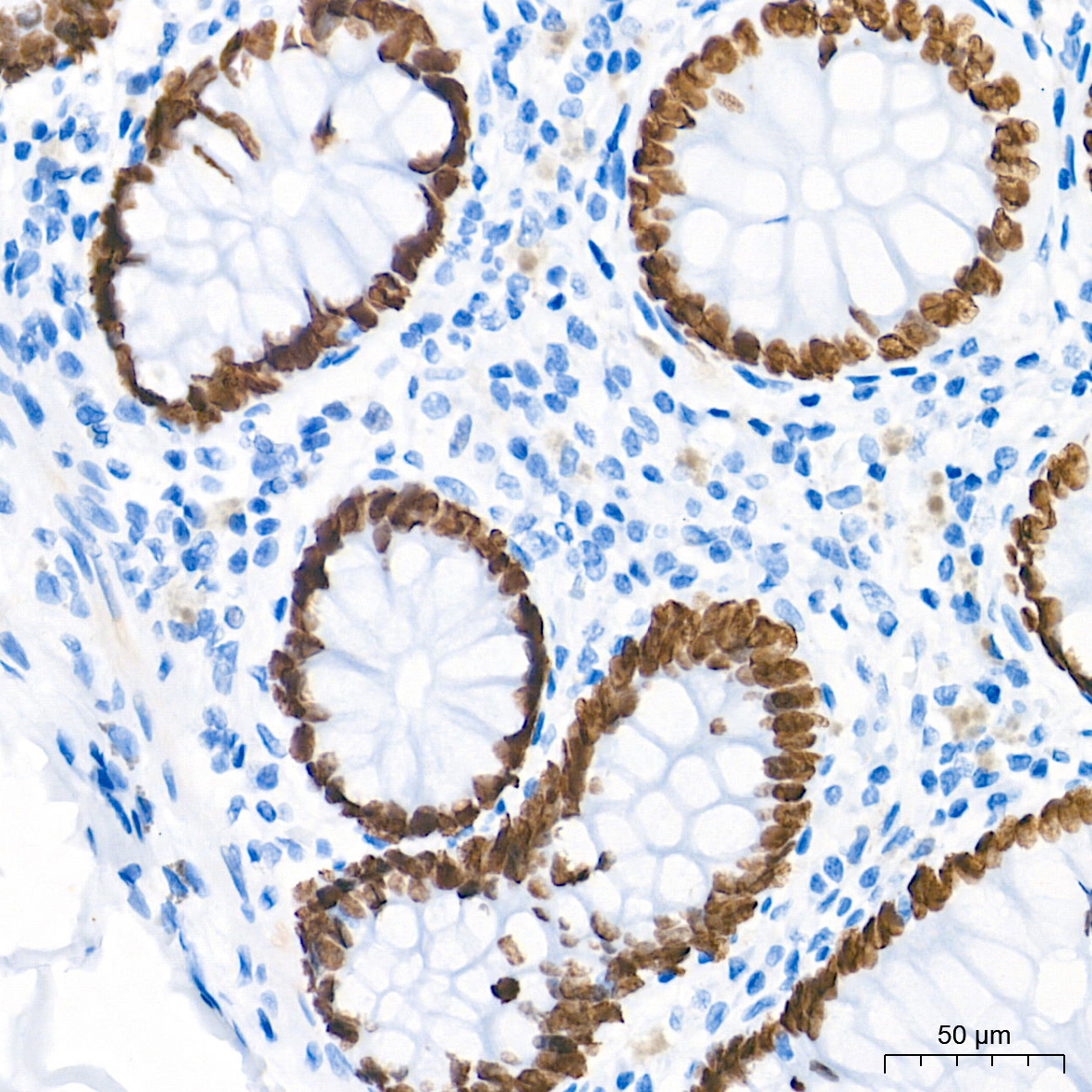 SATB2 Rabbit Monoclonal Antibody - Image 5