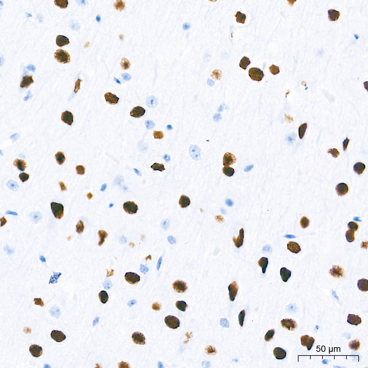 SATB2 Rabbit Monoclonal Antibody - Image 6