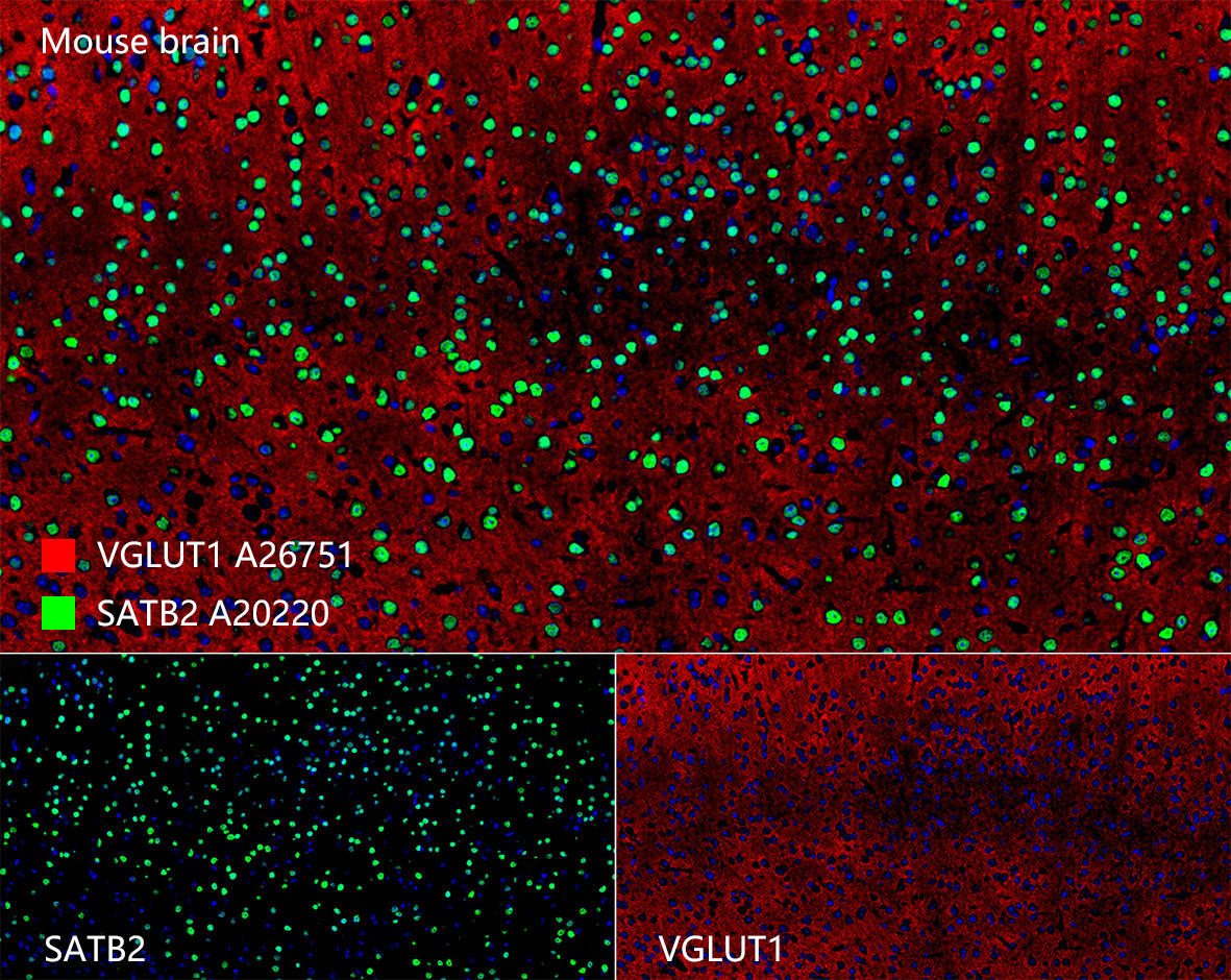 SATB2 Rabbit Monoclonal Antibody - Image 7