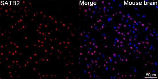 SATB2 Rabbit Monoclonal Antibody - Image 8