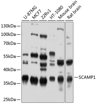 SCAMP1 Rabbit Polyclonal Antibody