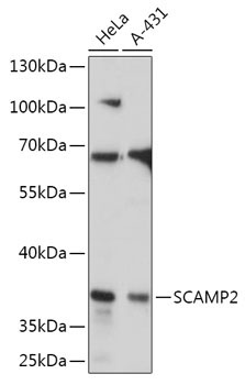 SCAMP2 Rabbit Polyclonal Antibody