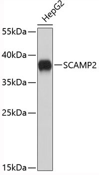 SCAMP2 Rabbit Polyclonal Antibody