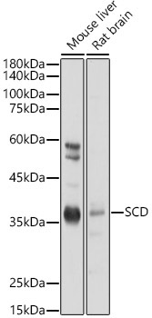 SCD Rabbit Polyclonal Antibody