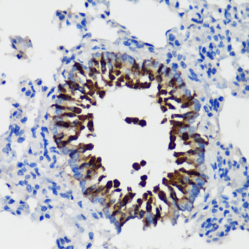 SCGB1A1 Rabbit Polyclonal Antibody - Image 2
