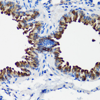 SCGB1A1 Rabbit Polyclonal Antibody - Image 3