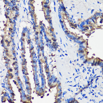 SCGB1A1 Rabbit Polyclonal Antibody - Image 4