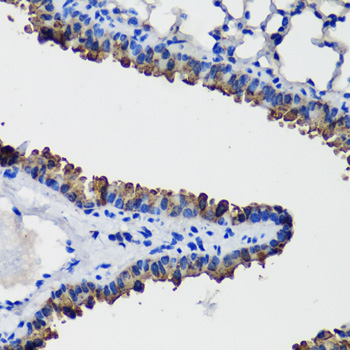 SCGB1A1 Rabbit Polyclonal Antibody - Image 5