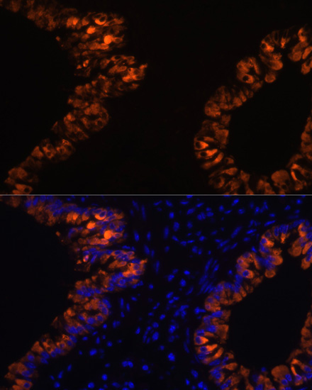 SCGB1A1 Rabbit Polyclonal Antibody - Image 6
