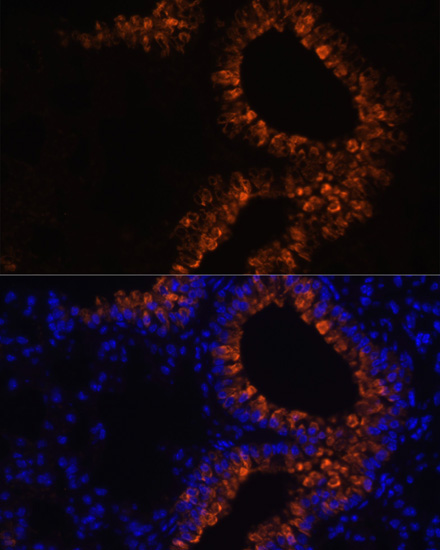 SCGB1A1 Rabbit Polyclonal Antibody - Image 7