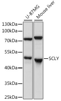 SCLY Rabbit Polyclonal Antibody