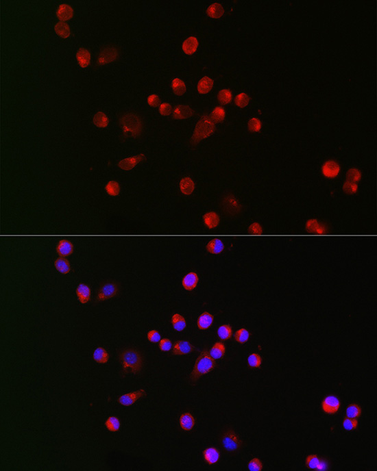 SCN10A Rabbit Polyclonal Antibody