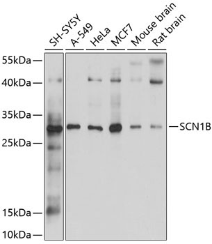 SCN1B Rabbit Polyclonal Antibody