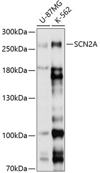 SCN2A Rabbit Polyclonal Antibody