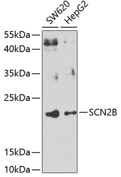 SCN2B Rabbit Polyclonal Antibody