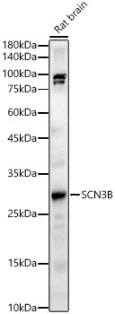 SCN3B Rabbit Polyclonal Antibody