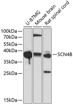 SCN4B Rabbit Polyclonal Antibody