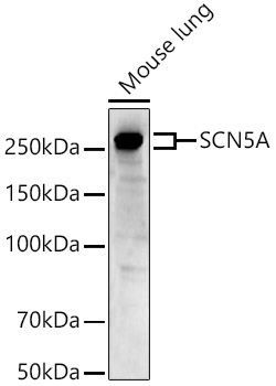 SCN5A Rabbit Polyclonal Antibody