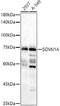 SCNN1A Rabbit Polyclonal Antibody