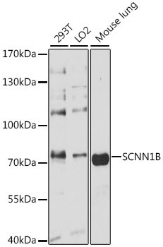 SCNN1B Rabbit Polyclonal Antibody