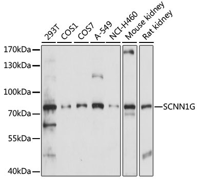 SCNN1G Rabbit Polyclonal Antibody