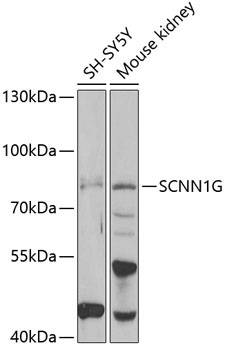 SCNN1G Rabbit Polyclonal Antibody