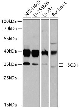 SCO1 Rabbit Polyclonal Antibody