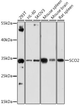 SCO2 Rabbit Polyclonal Antibody