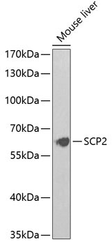 SCP2 Rabbit Polyclonal Antibody