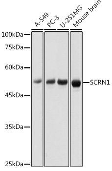 SCRN1 Rabbit Polyclonal Antibody - Image 2