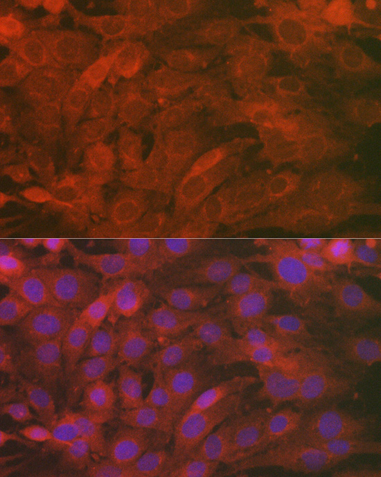 SCRN1 Rabbit Polyclonal Antibody - Image 3