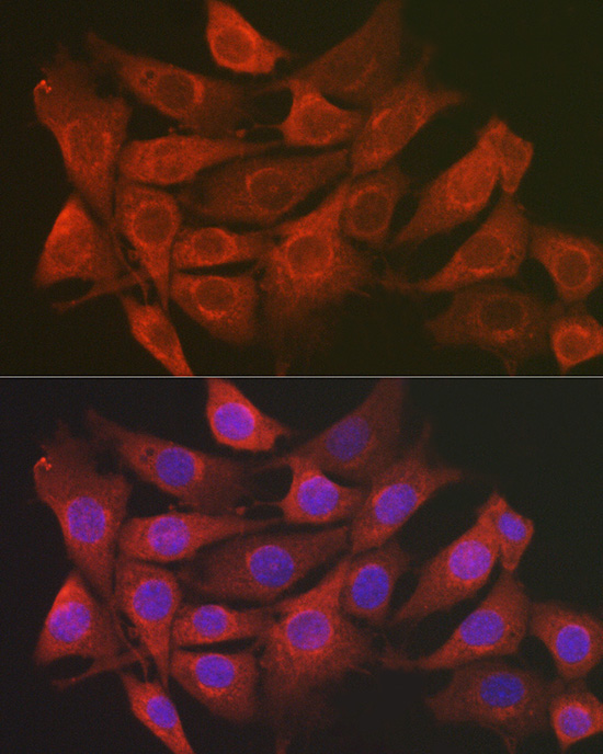 SCRN1 Rabbit Polyclonal Antibody - Image 4