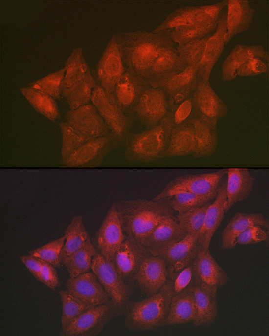 SCRN1 Rabbit Polyclonal Antibody - Image 5