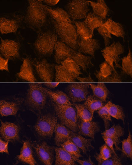 SCRN3 Rabbit Polyclonal Antibody - Image 2