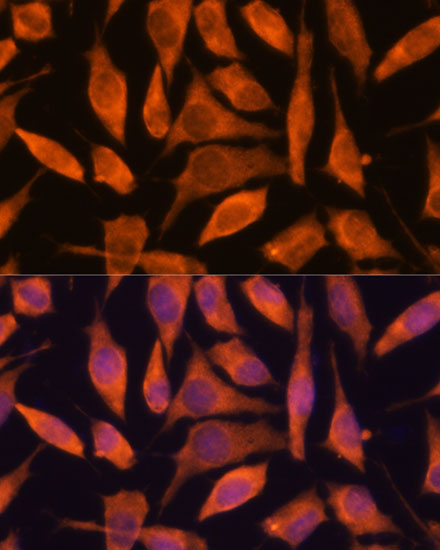 SCRN3 Rabbit Polyclonal Antibody - Image 3